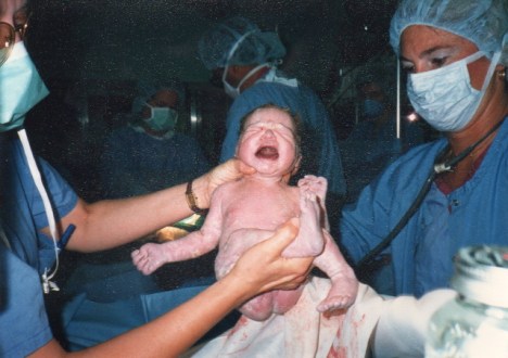 No gloves